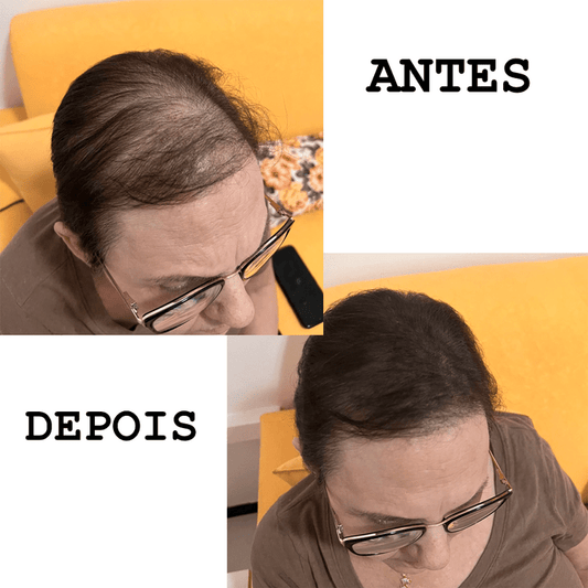 Antes depois maquiagem SEVICH