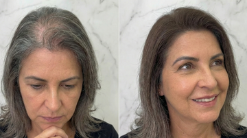 Como Retoque de Raiz Sem Tintura Pode Transformar o Seu Visual no Dia a Dia